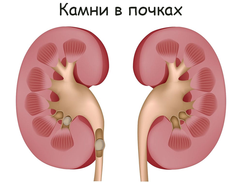 Как оплатить заказ в кракене